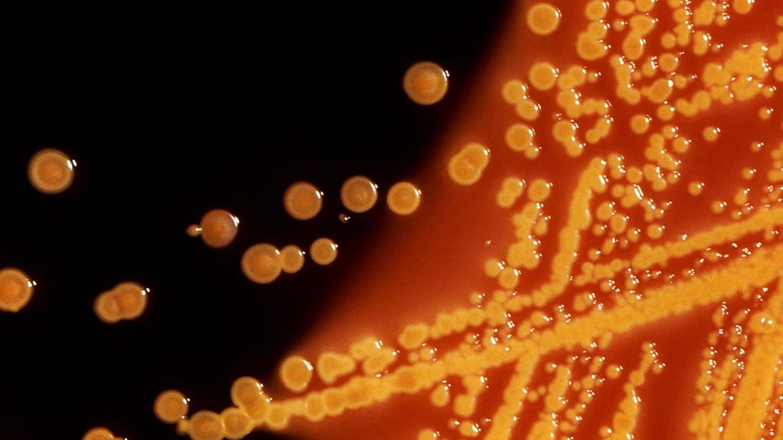E.coli-Outbreak (Image via Calgary Herald)